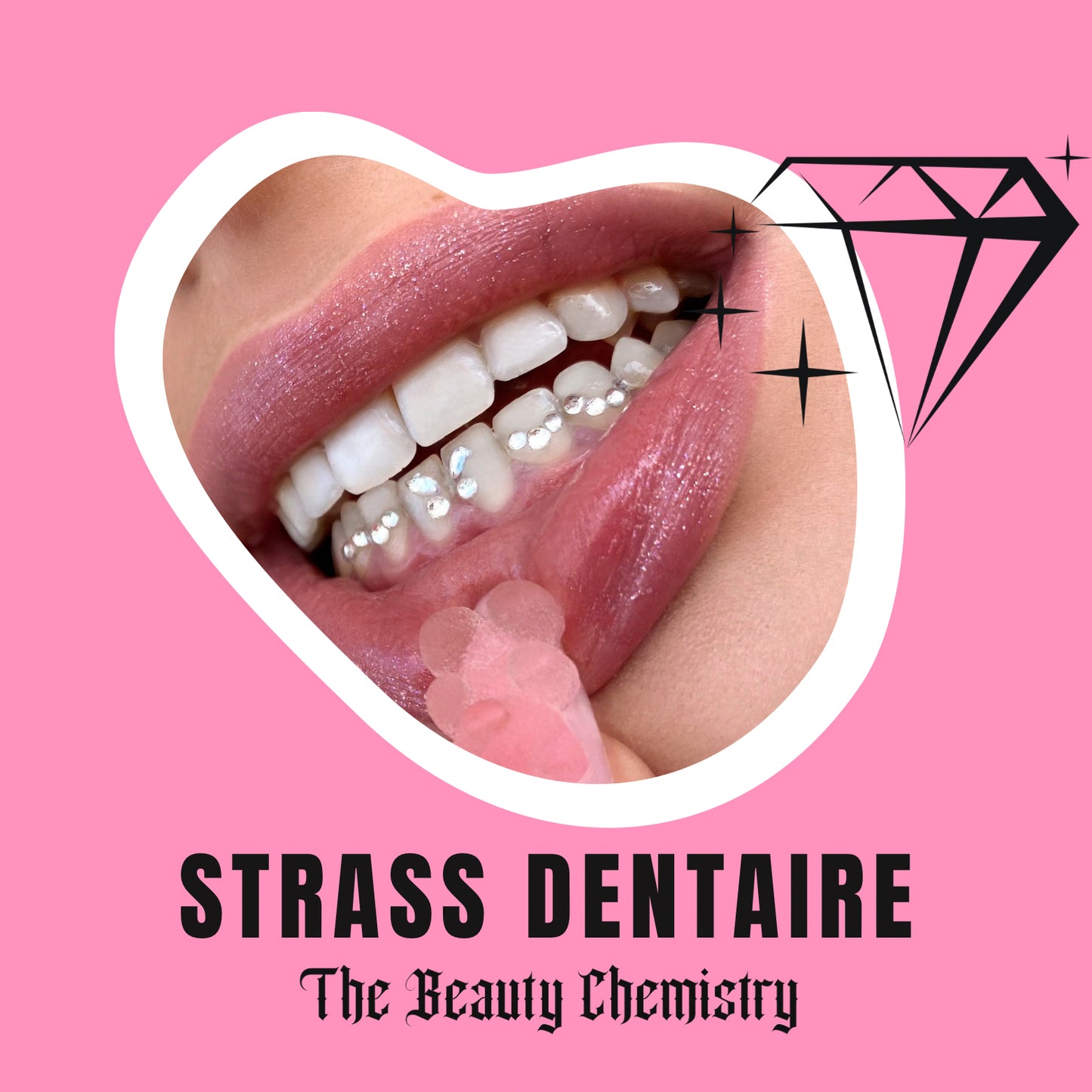 Ebook Strass dentaire